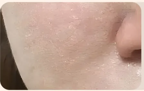 Brosse de Nettoyage du Visage Électrique — Rotation Chaude & Froide